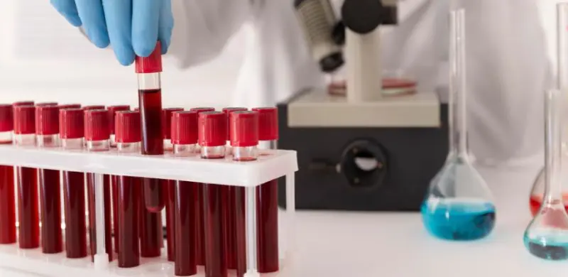 Consultation pour prélèvements sanguins à Saint-Augustin-de-Desmaures, Québec, Canada